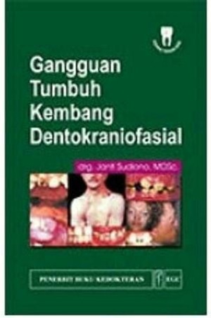 Gangguan Tumbuh Kembang Dentokraniofasial