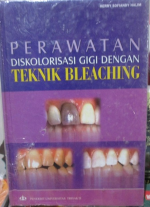 PERAWATAN DISKOLORISASI GIGI DENGAN TEKNIK BLEACHING