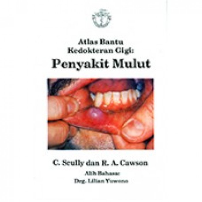 Atlas Bantu Kedokteran Gigi: Penyakit Mulut