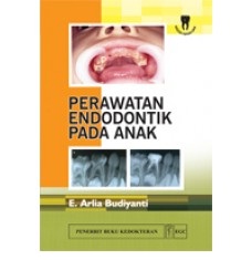 Perawatan Endodontik Pada Anak