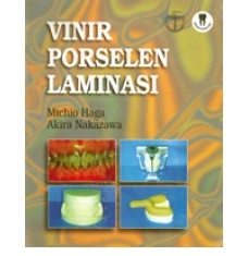 Vinir Porselen Laminasi