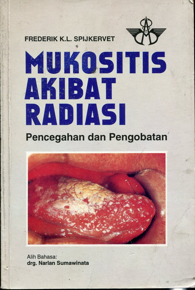 Mukositis Akibat Radiasi