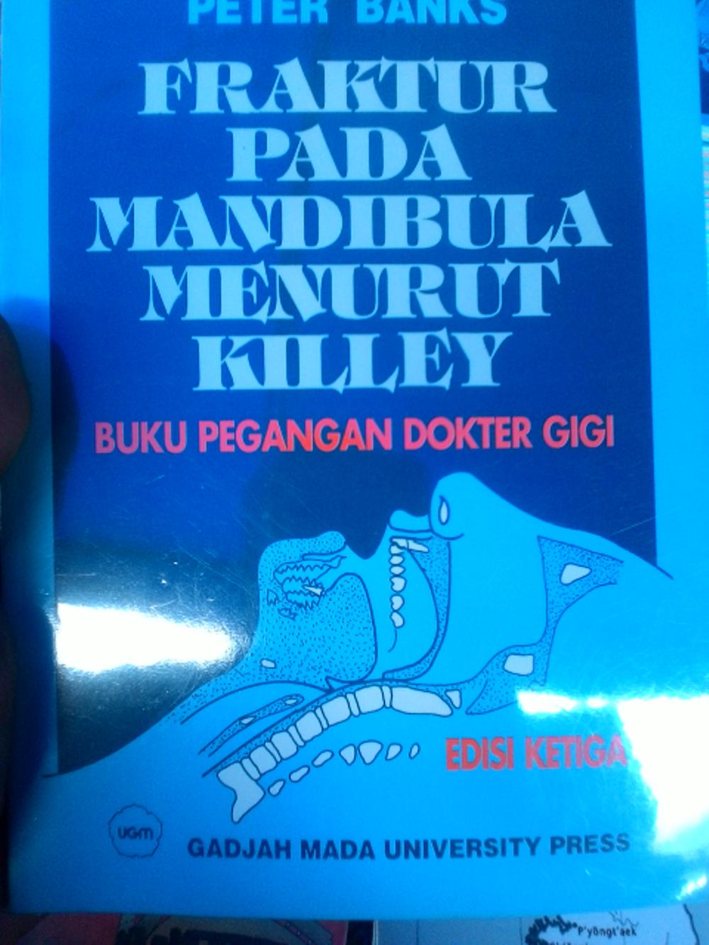 fraktur pada mandibula menurut killey