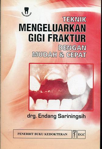 Teknik Mengeluarkan Gigi Fraktur Dengan Mudah & Cepat