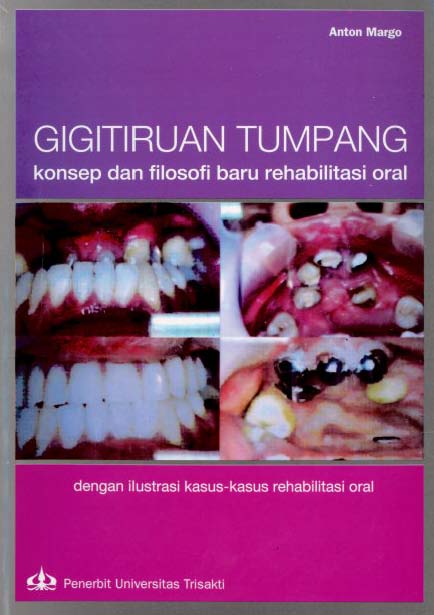 GIGITIRUAN TUMPANG konsep dan filosofi baru rehabilitasi oral