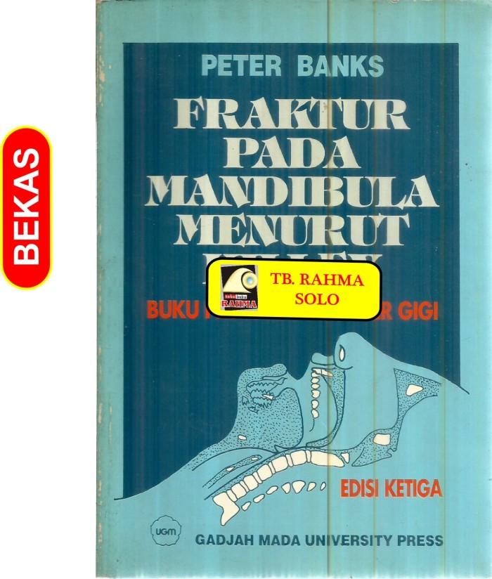 Fraktur pada mandibula manurut Killey